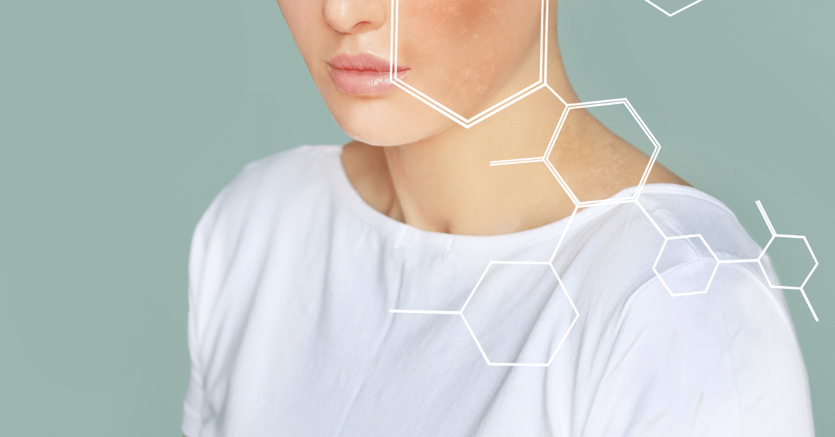 Understanding Pigmentation: Why It Happens and How to Restore Your Natural Glow - Anahiherbs