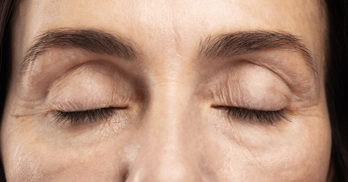 Why Do We Get Baggy Eyes or Dark Circles? Uncovering the Truth Behind Tired Eyes - Anahiherbs